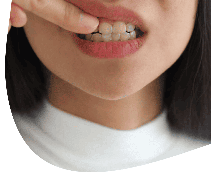 Kontrola dásní nervózním nebo úzkostným gestem s důrazem na ústa.