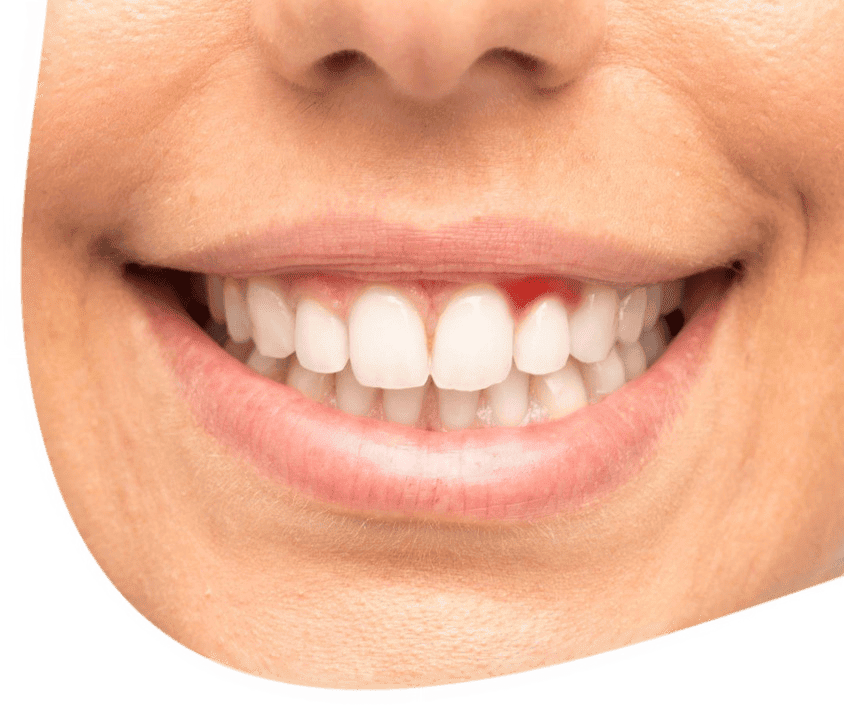Široký úsměv člověka se zdravými, bílými zuby.